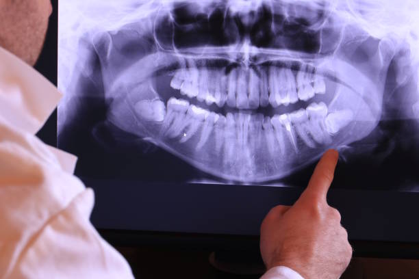 Best Urgent Tooth Repair  in Bridgeport, TX