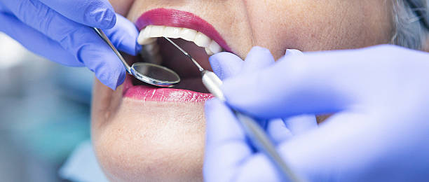 Best Dentist for Dental Trauma  in Bridgeport, TX